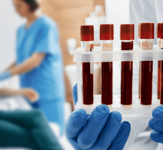 Lab Test